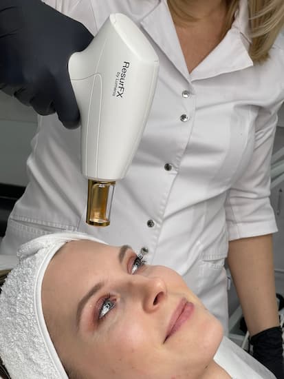 Лазерная шлифовка лица