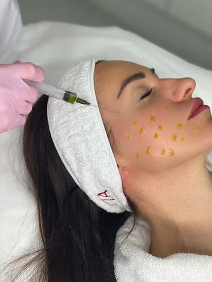 Ретиноловый пилинг